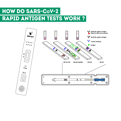 How Does the SARS-CoV-2 Rapid Antigen Test Kit Work?