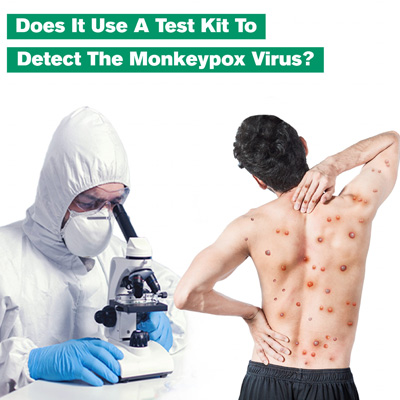 Does It Use a Test Kit to Detect The Monkeypox Virus?