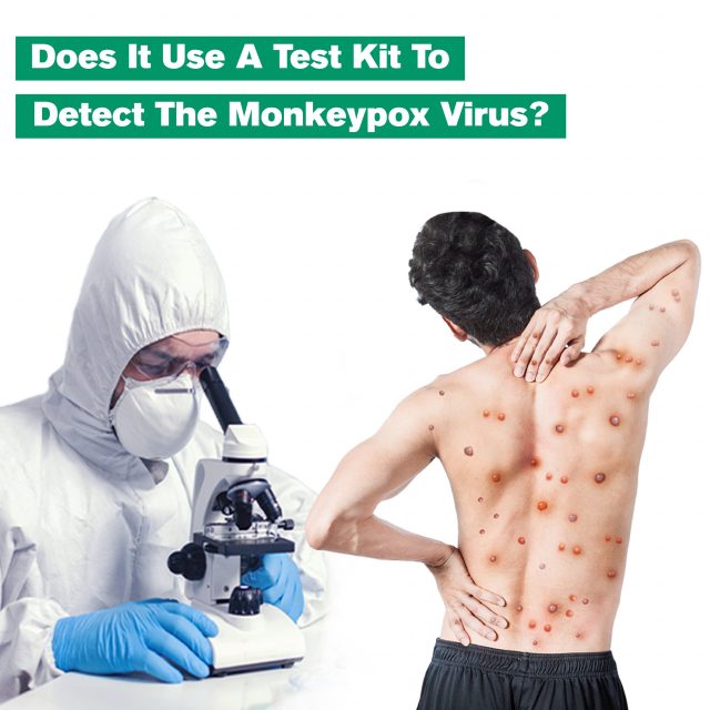 Does It Use a Test Kit to Detect The Monkeypox Virus scaled 2
