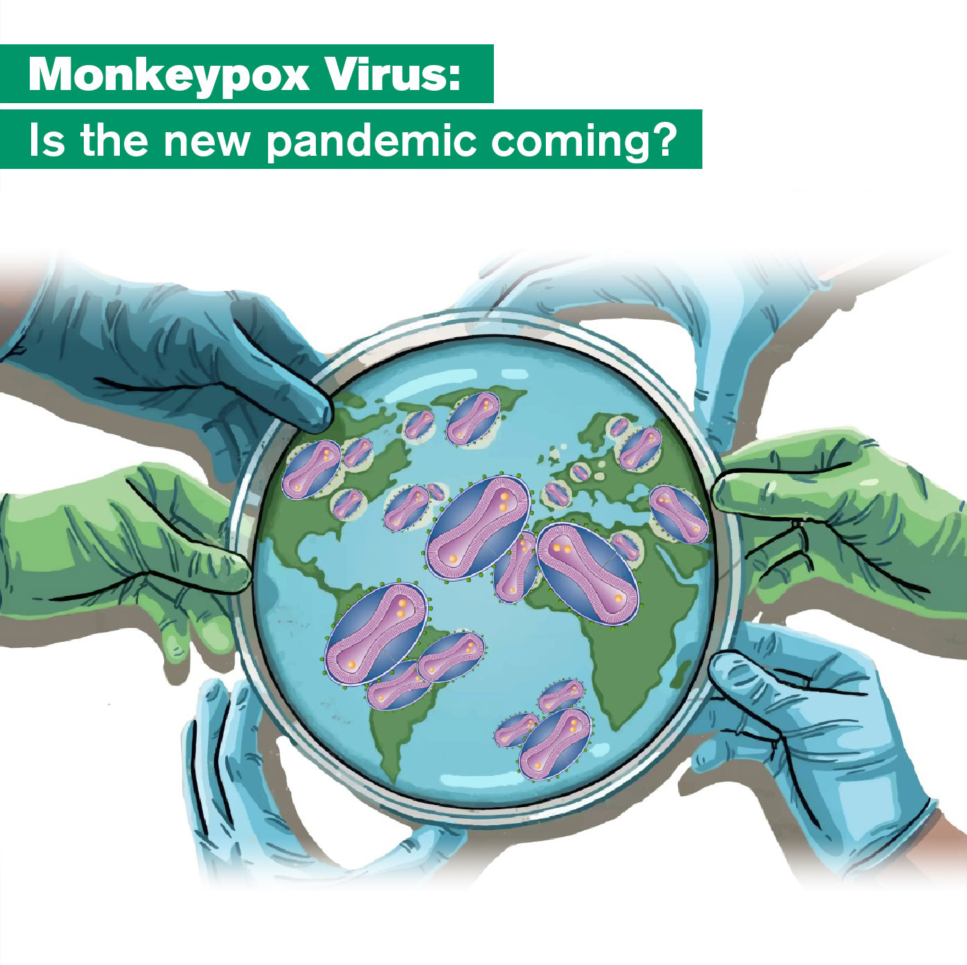 Monkeypox Virus Is the new pandemic coming