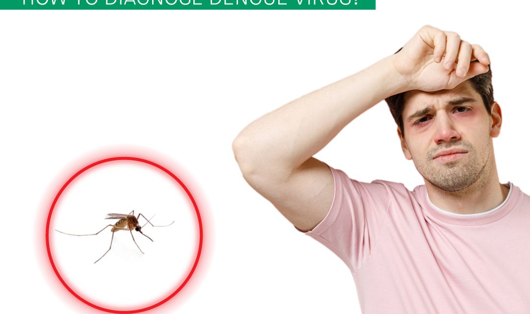 What is Dengue Fever and How to Diagnose Dengue Virus?