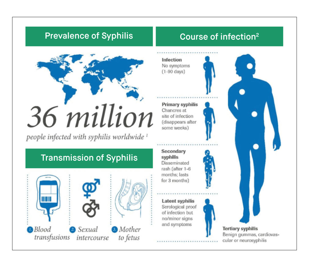 How is Syphilis Diagnosed and Treated