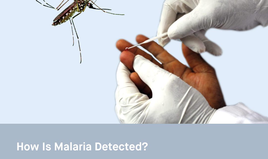 How Is Malaria Detected?