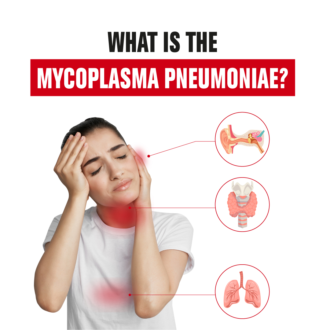 What is the Mycoplasma pneumoniae? - Vitrosens Biotechnology - Human and  Animal Health Rapid Test Kits
