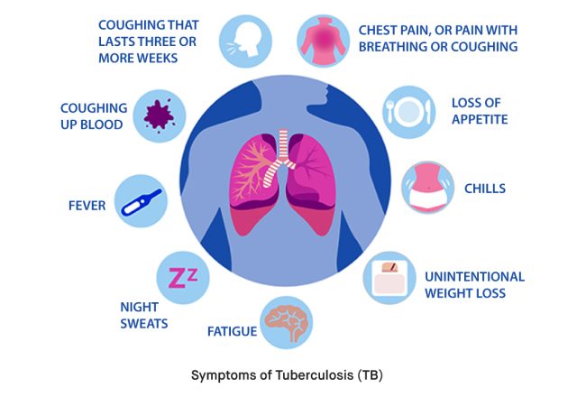 What Are the Symptoms of Tuberculosis TB