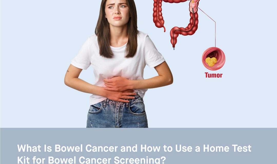 What Is Bowel Cancer and How to Use a Home Test Kit for Bowel Cancer Screening?