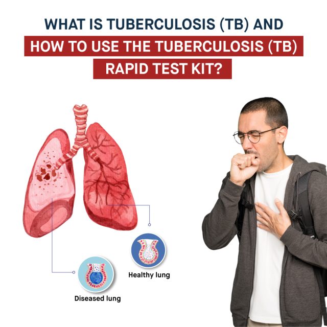 What is Tuberculosis TB and How to Use the Tuberculosis TB Rapid Test Kit