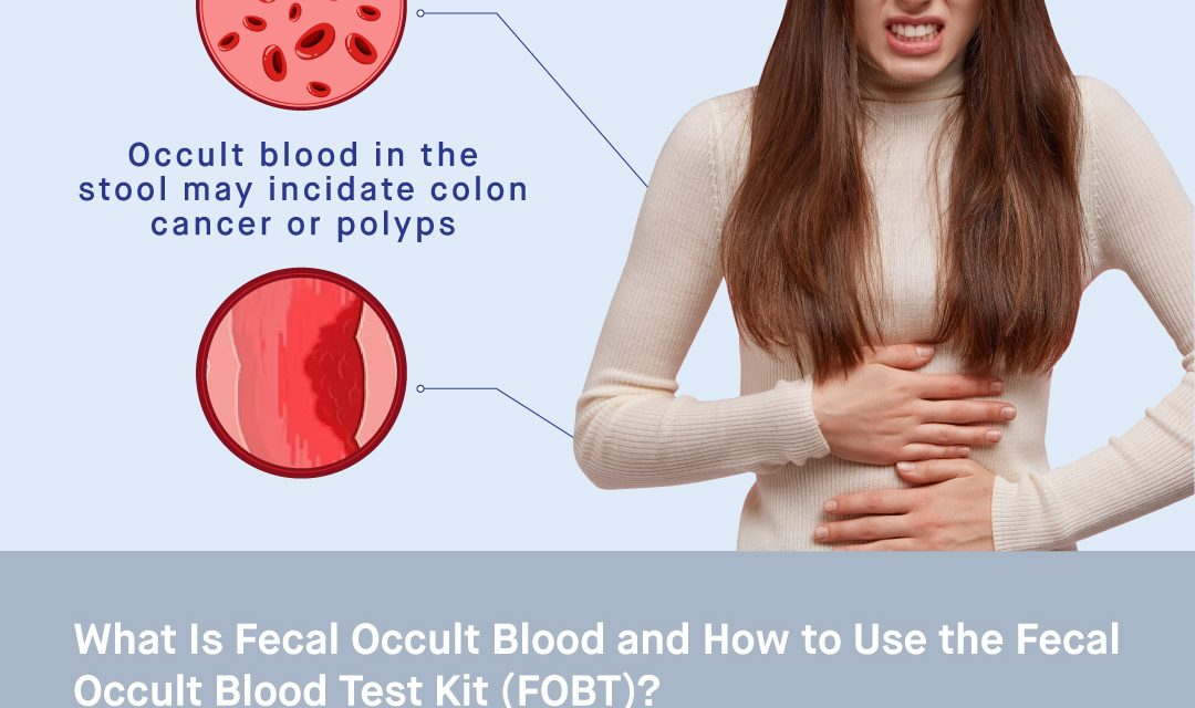 What Is Fecal Occult Blood and How to Use the Fecal Occult Blood Test Kit (FOBT)?