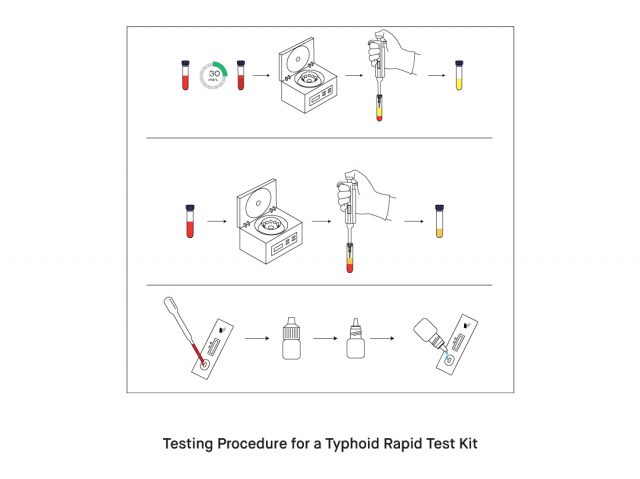 How to Use the Typhoid Rapid Test Kit