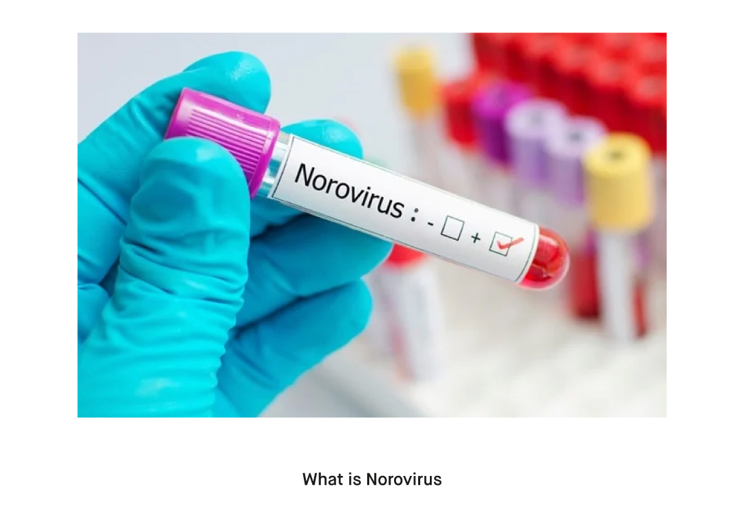 Norovirus can be persistent