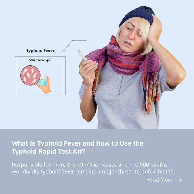 What Is Typhoid Fever and How to Use the Typhoid Rapid Test Kit ...