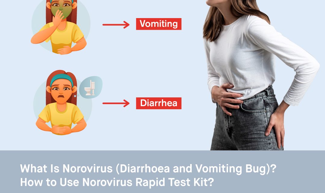 What is Norovirus (Diarrhoea and Vomiting Bug)? How to Use Norovirus Rapid Test Kit?