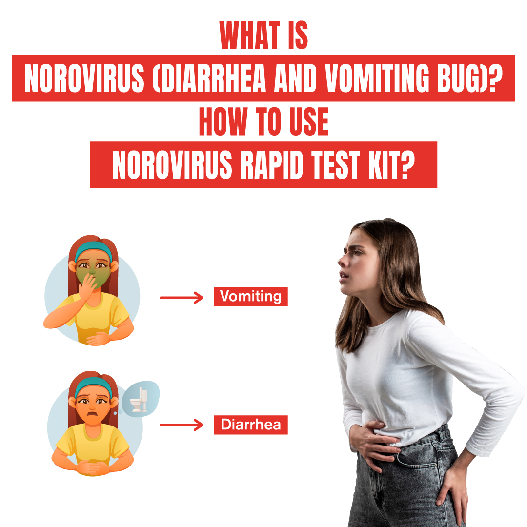 what is norovirus