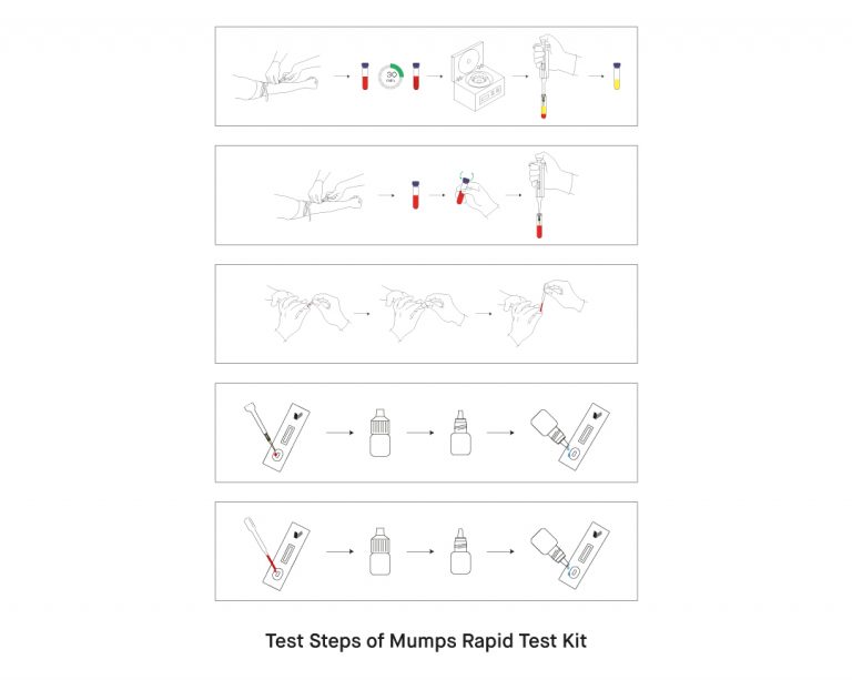 What is Mumps Virus and How to Use Mumps Virus Rapid Test Kit ...