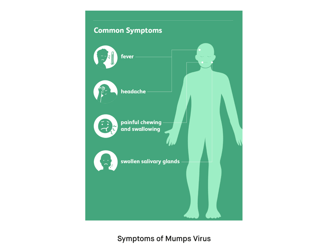 What are the Symptoms of Mumps Virus