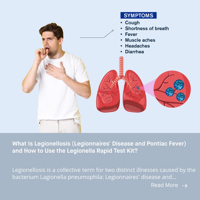 Legionella Skin Rash What is Legionellosis (Legionnaires' Disease and Pontiac Fever) and How ...