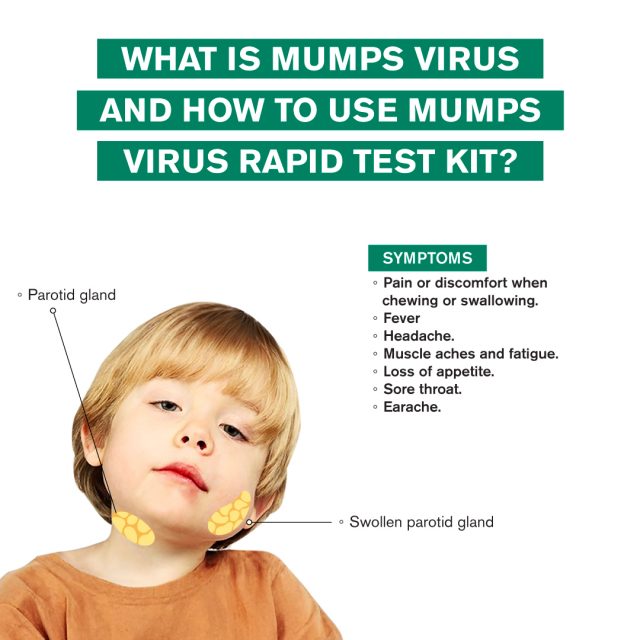 What is Mumps Virus and How to Use Mumps Virus Rapid Test Kit ...