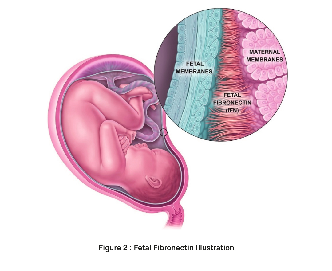 What is Fetal Fibronectin Rapid Test Kit