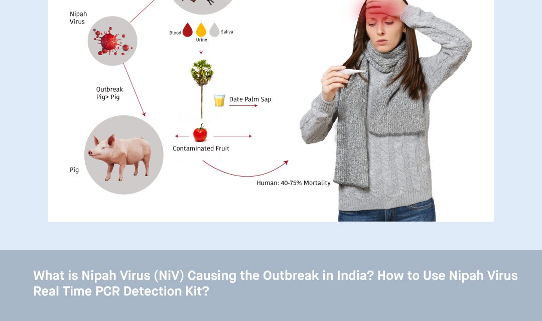 What is Nipah Virus (NiV) Causing the Outbreak in India? How to Use Nipah Virus Real Time PCR Detection Kit?