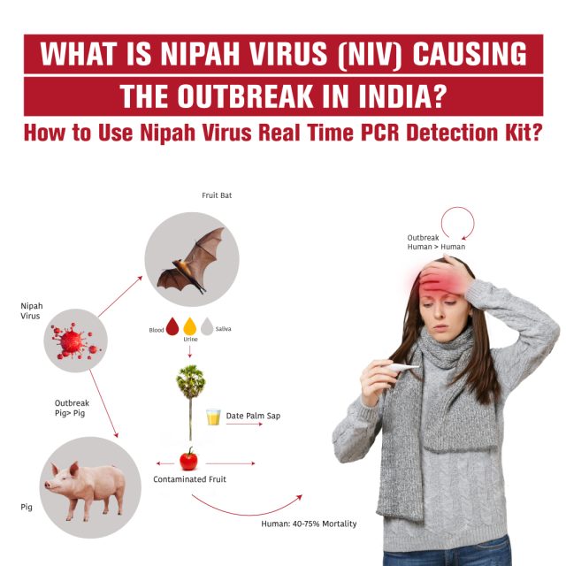 What is Nipah Virus NiV Causing the Outbreak in India How to Use Nipah Virus Real Time PCR Detection Kit.