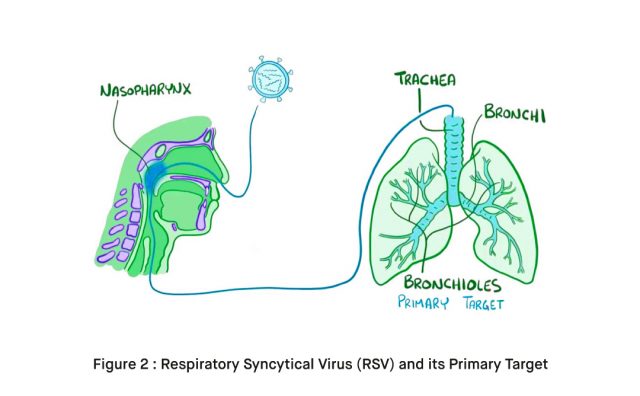 What is Respiratory Syncytial Virus RSV