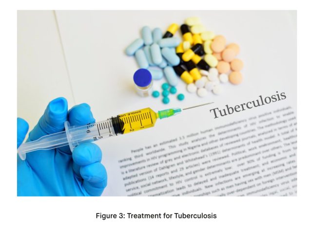 Treatment for Tuberculosis