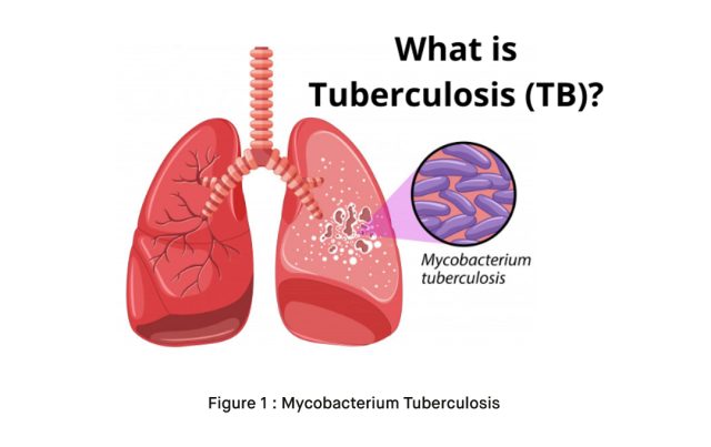 What is Mycobacterium Tuberculosis TB