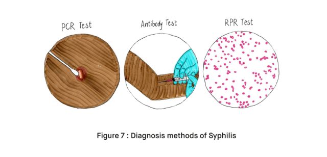 Diagnosis methods of Syphilis