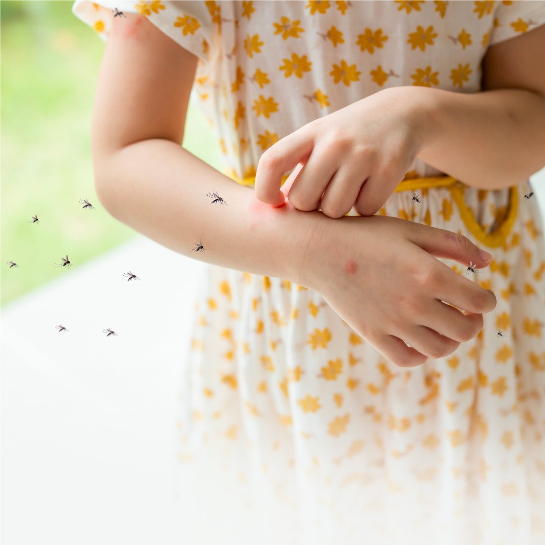 Malaria Testing Evolution The Role of P.f. pLDH:HRP2 Rapid Test Kits in Early Detection