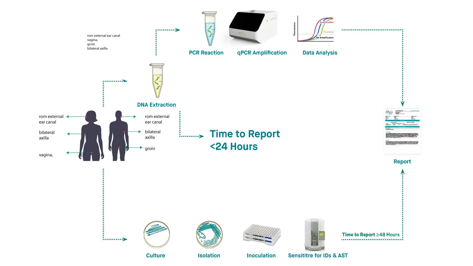Figure 2: Culture based vs PCR testing workflows