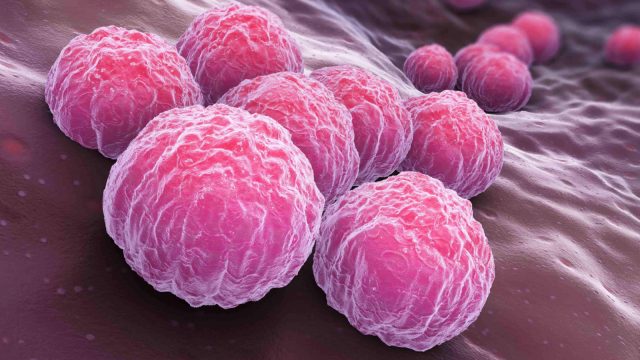 Early Detection, Better Protection: RapidFor Chlamydia + Gonorrhea ...