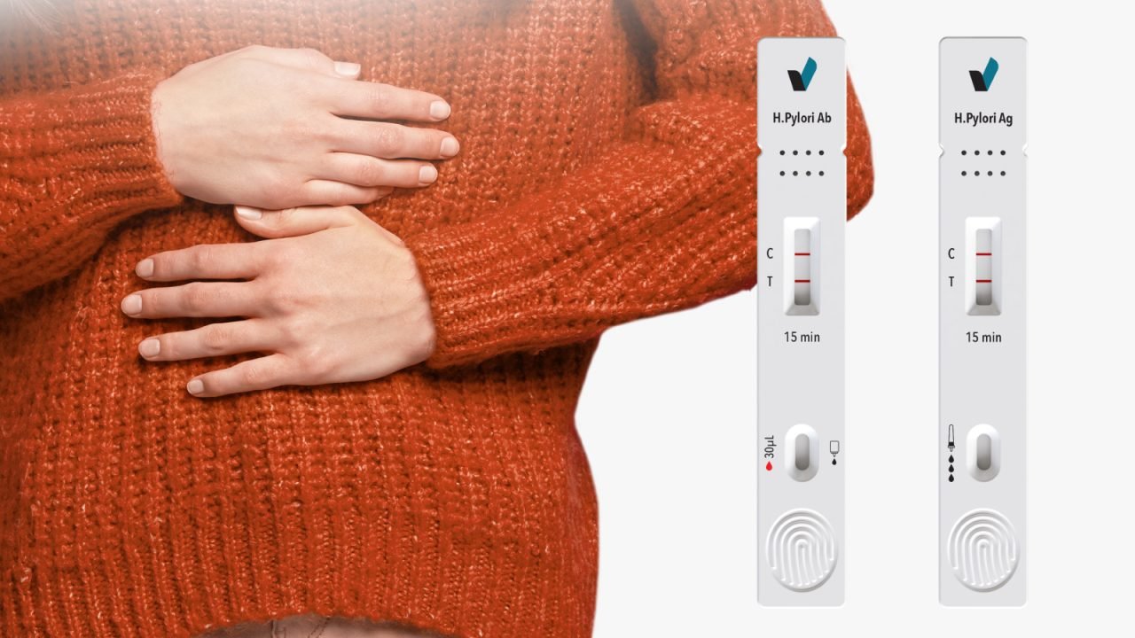 Helicobacter pylori in Focus: Why Antigen and Antibody Rapid Tests Matter in Modern Gastric Diagnostics