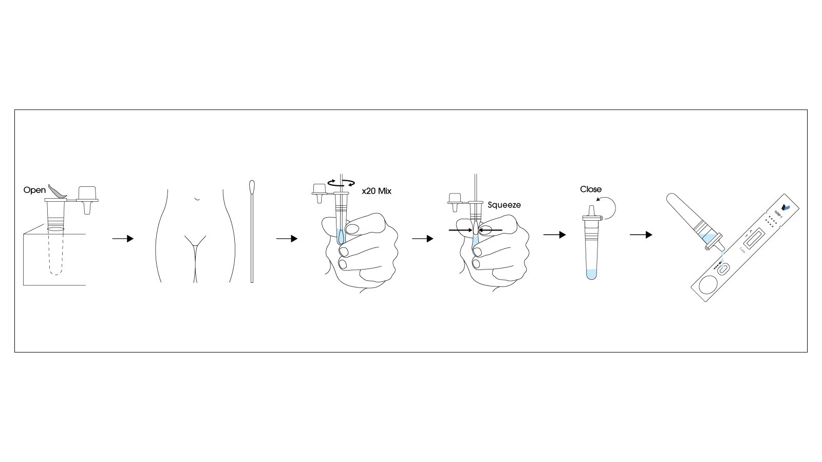 Premature Rupture of Membranes (PROM): The Critical Role of iGFBP-1 Rapid Testing in Maternal Care 3 Figure 3: Step-by-step visual guide demonstrating proper sample collection technique and test cassette use