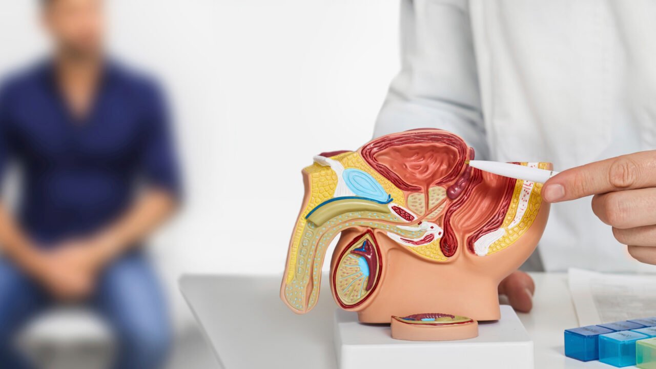 PSA Testing and Prostate Cancer: How Total PSA and Free PSA Ratio Improve Diagnostic Accuracy
