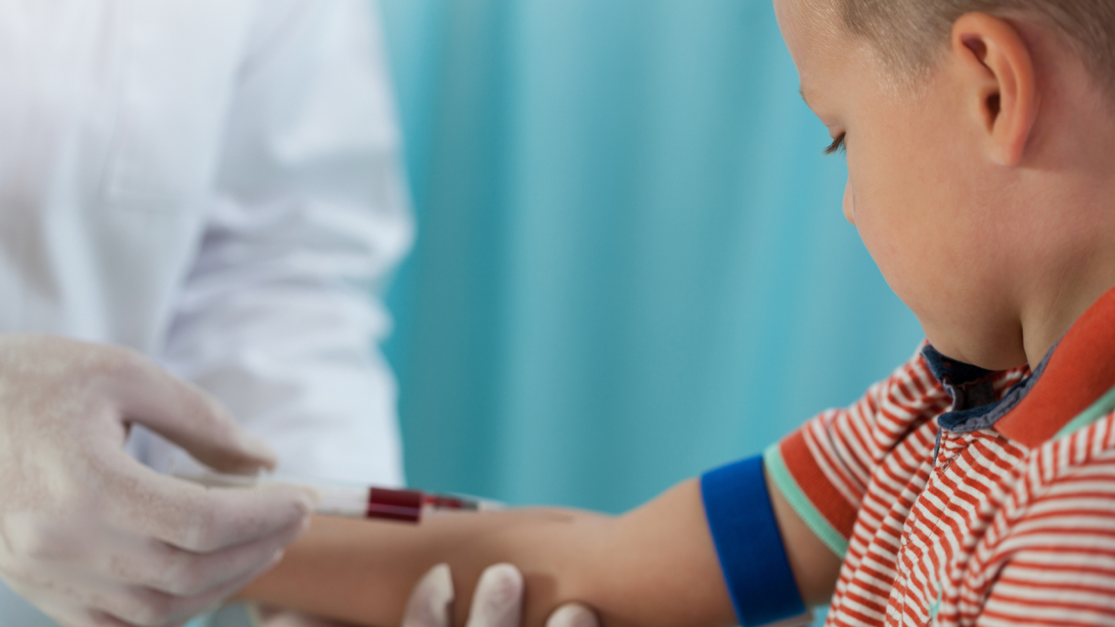 Measles Outbreaks in 2026: The Growing Need for Rapid IgG/IgM Testing
