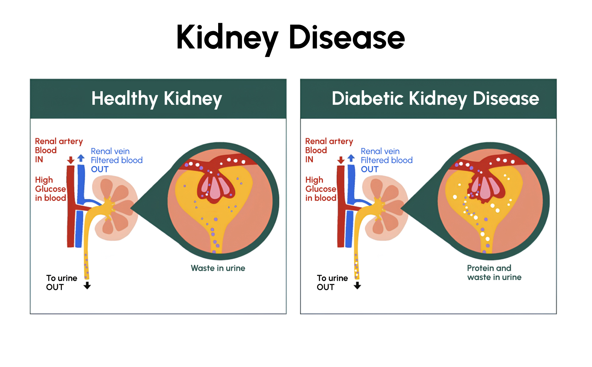 Figure 1: Kidney function assessment is an important part of long-term diabetes care.