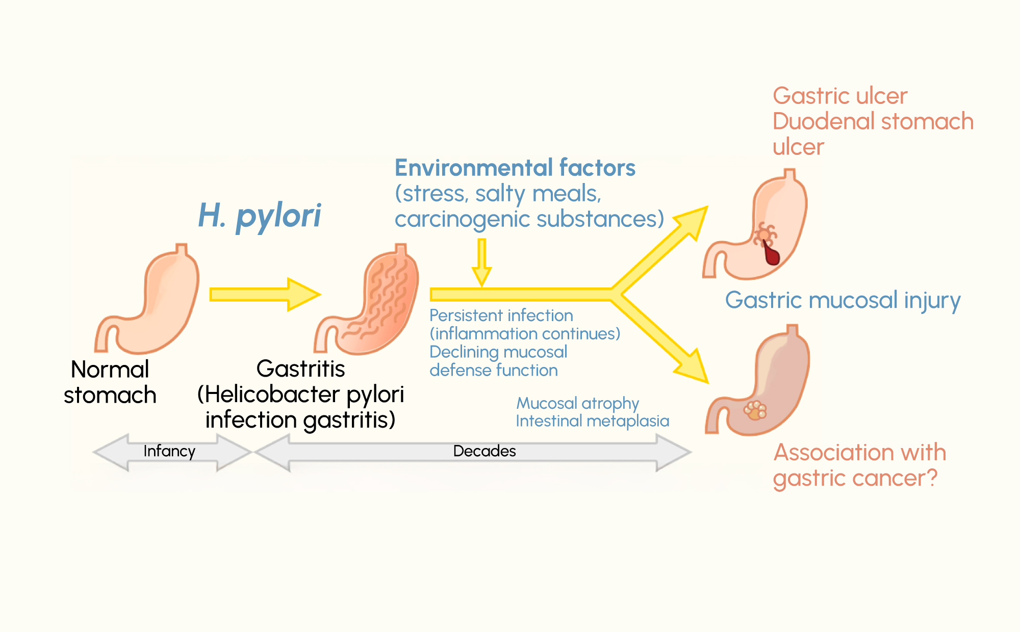Figure 1. Illustration of the potential progression of persistent H. pylori infection from gastritis to gastric mucosal changes and associated complications.