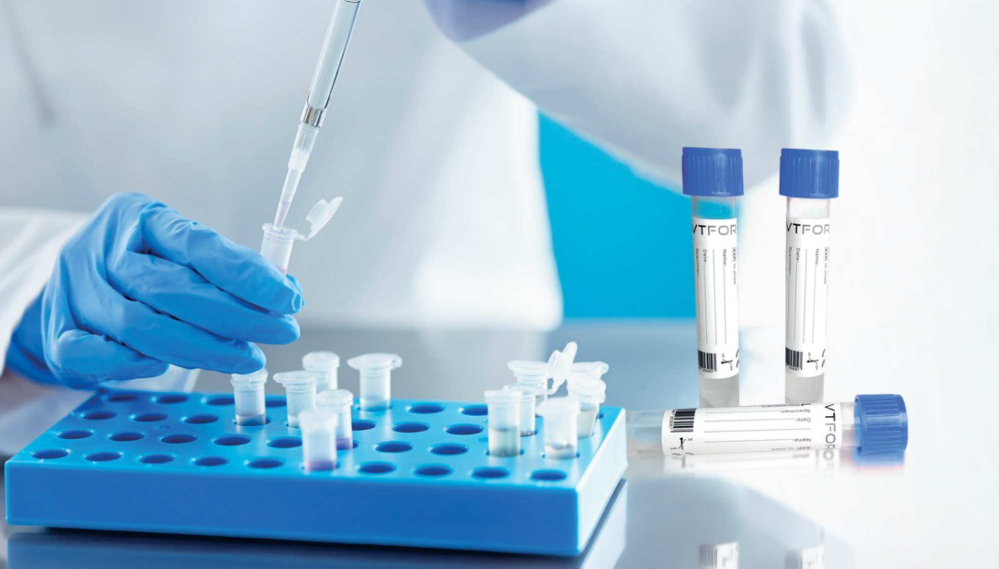 Figure 2: Sample handling and processing using VTFOR™ transport medium tubes in a molecular laboratory setting.